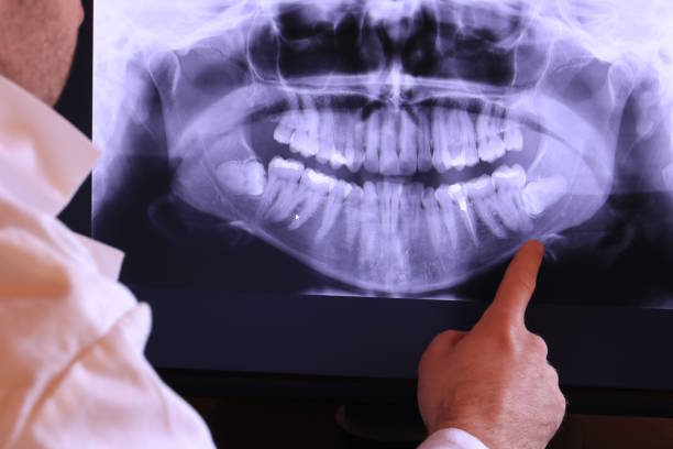 Best Emergency Dentist Near Me  in Pine Manor, FL