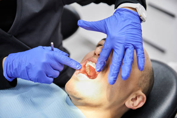 Best Emergency Tooth Extraction  in Pine Manor, FL